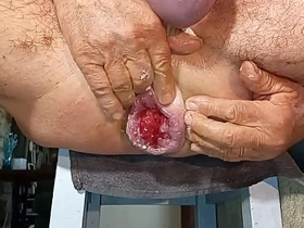 扩肛侠2025-14 japan gay porn gym