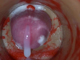 内射实录——体内镜头捕捉男性深喉射精 porn gay boy hot