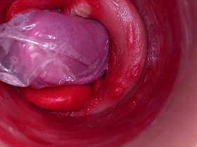 深入阴道的摄像头记录下带着套套的巨量射精 chinese vs asian joyful porn